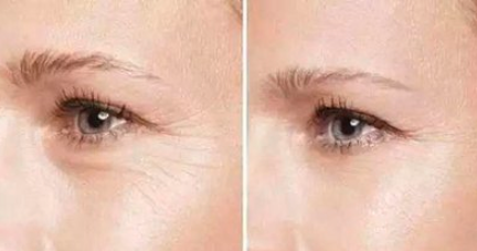 <b>眼部皮肤护理：男士眼部祛痘控油护肤品排行榜哪个牌子好</b>