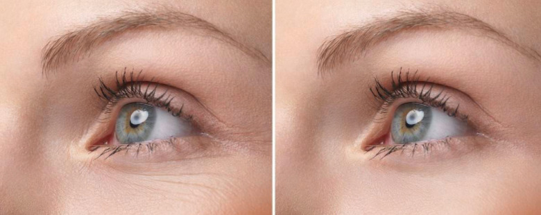 <b>眼部皮肤护理：春天女人眼部嫩白护肤套装</b>