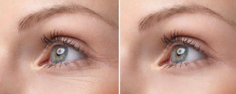 <b>眼部皮肤护理：秋天女生眼部润肤孕妇护肤品</b>