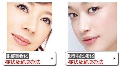眼纹也分真假 分清楚做护肤才能更显年轻